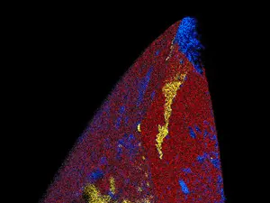EDX map of contamination on a hypodermic needle