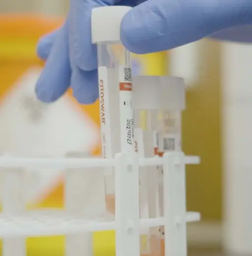A sample tube being removed from a tube rack
