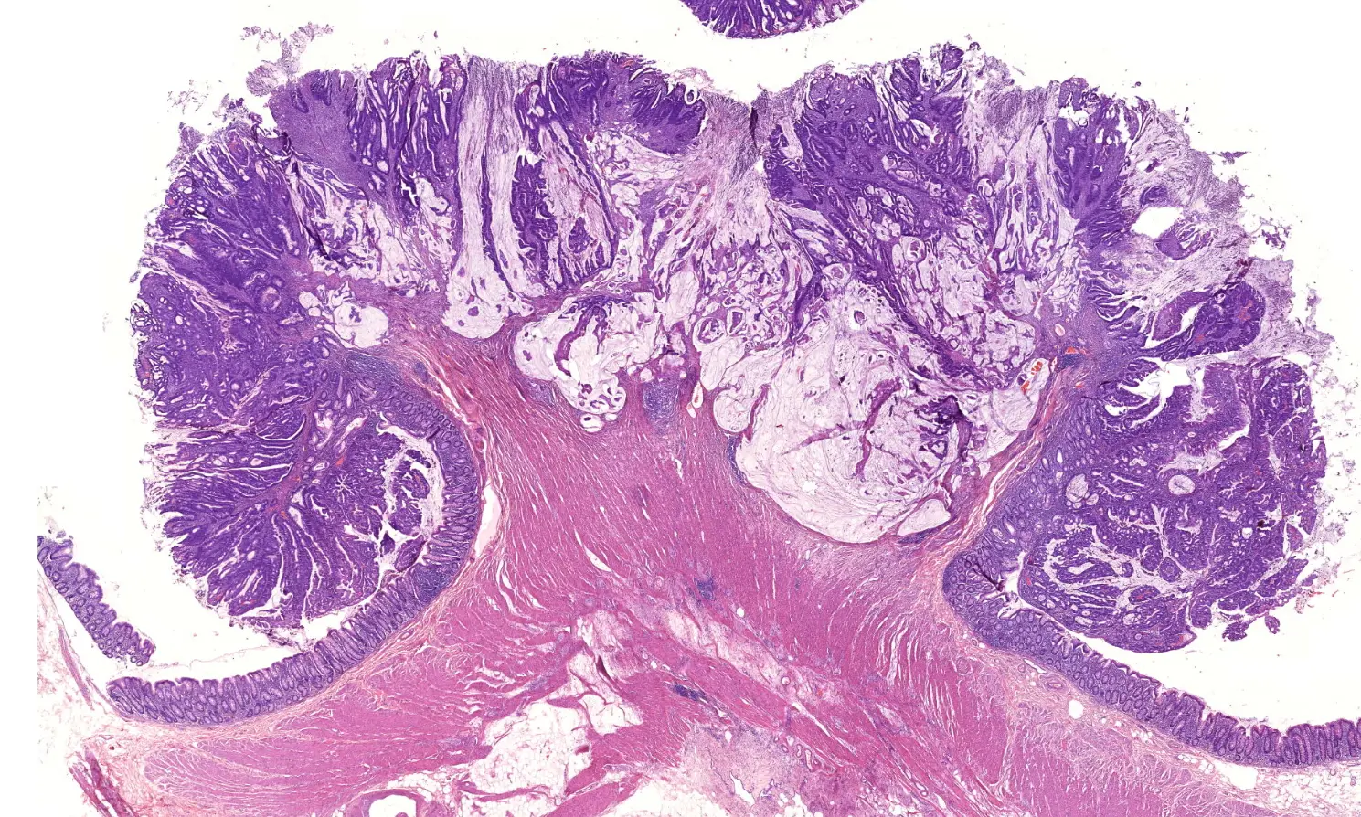 Optical microscope image of a pathology slide