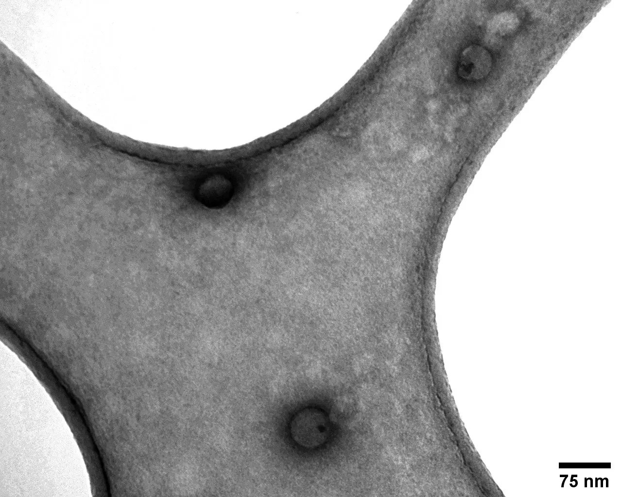 Transmission electron microscopy image of negatively stained polymer nanoparticles