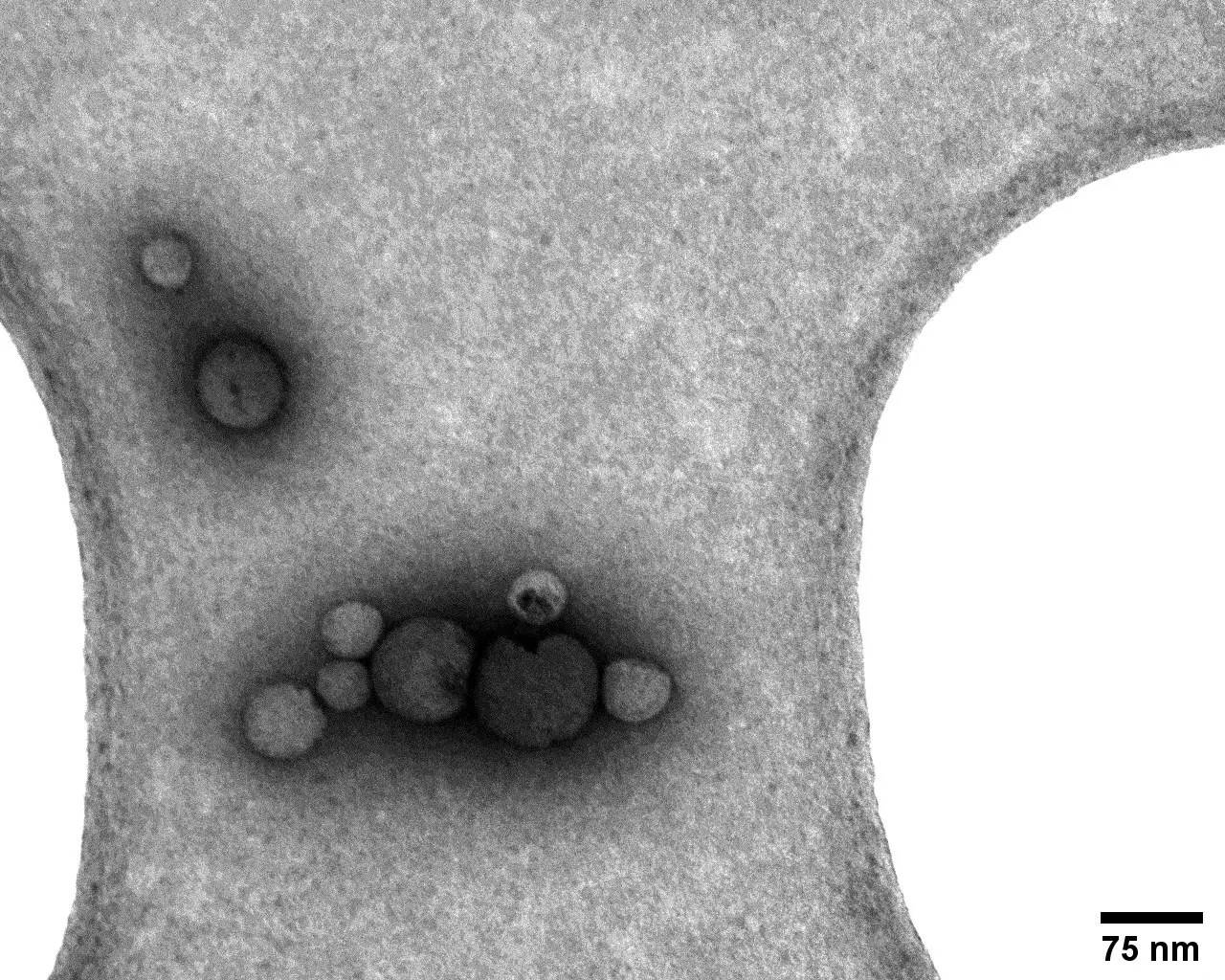 Transmission electron microscopy image of negatively stained polymer nanoparticles