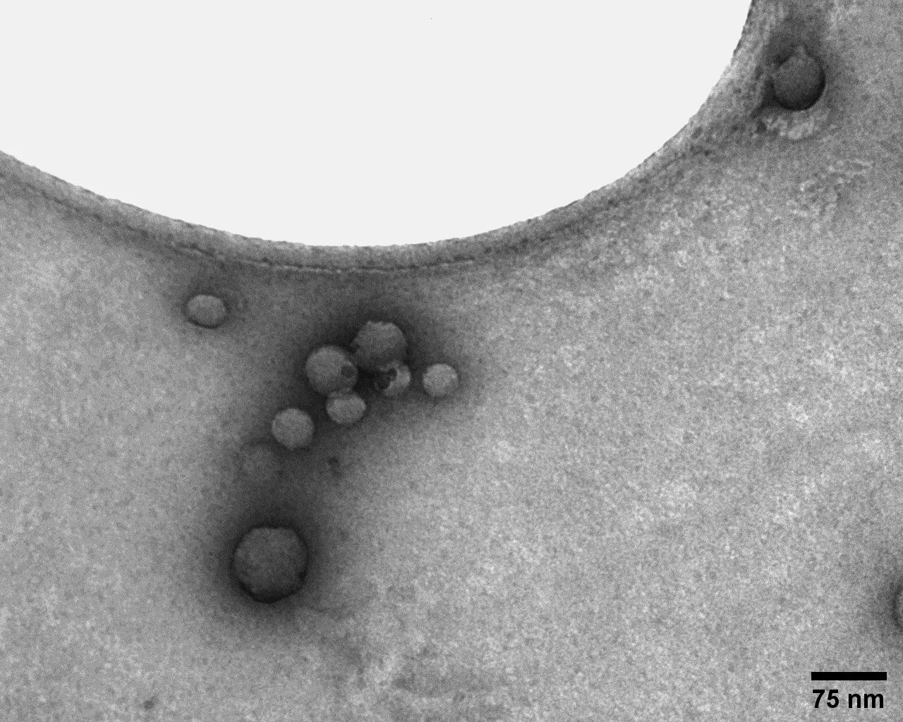 Transmission electron microscopy image of negatively stained polymer nanoparticles