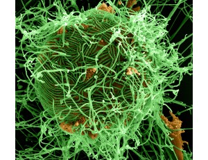 Scanning electron microscopy (SEM) image of the Ebola virus